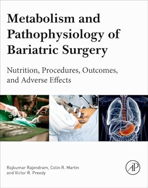 Bild des Verkufers fr Metabolism and Pathophysiology of Bariatric Surgery : Nutrition, Procedures, Outcomes and Adverse Effects zum Verkauf von GreatBookPricesUK