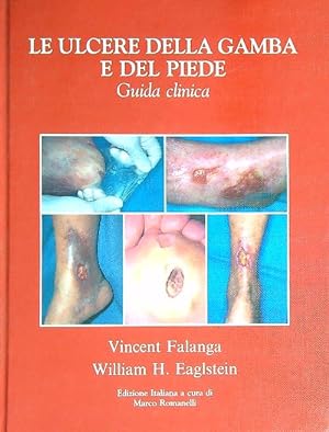 Bild des Verkufers fr Le ulcere della gamba e del piede. Guida clinica zum Verkauf von Librodifaccia