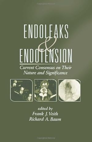 Seller image for Endoleaks and Endotension: Current Consensus on Their Nature and Significance [Hardcover ] for sale by booksXpress
