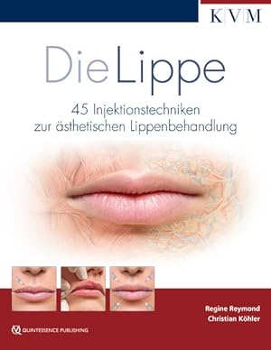 Imagen del vendedor de Die Lippe: 45 Injektionstechniken zur sthetischen Lippenbehandlung a la venta por Studibuch