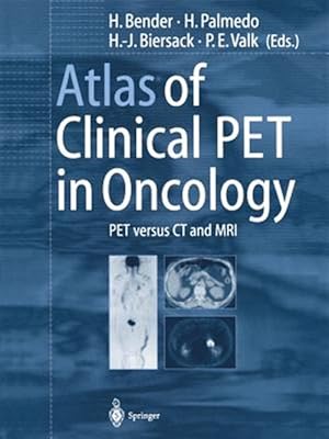 Seller image for Atlas of Clinical Pet in Oncology : Pet Versus Ct and MRI for sale by GreatBookPrices