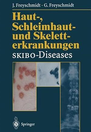 Seller image for Haut-, Schleimhaut- und Skeletterkrankungen Skibo-Diseases : Eine Dermatologische-Klinisch-Radiologische Synopse -Language: german for sale by GreatBookPrices
