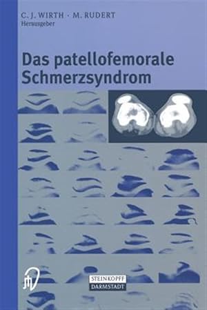Imagen del vendedor de Das Patellofemorale Schmerzsyndrom -Language: german a la venta por GreatBookPrices
