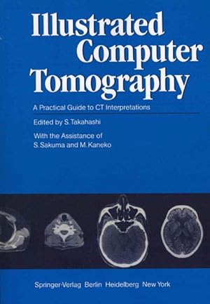 Seller image for Illustrated Computer Tomography : A Practical Guide to CT Interpretations for sale by GreatBookPrices