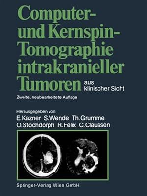 Bild des Verkufers fr Computer- Und Kernspin-tomographie Intrakranieller Tumoren Aus Klinischer Sicht -Language: german zum Verkauf von GreatBookPrices