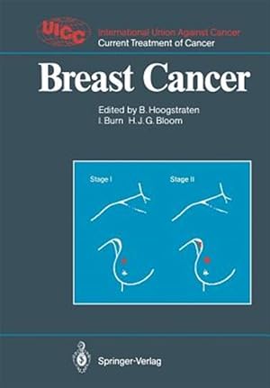 Seller image for Breast Cancer for sale by GreatBookPrices