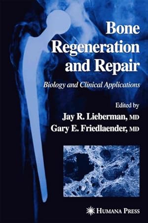 Image du vendeur pour Bone Regeneration and Repair : Biology and Clinical Applications mis en vente par GreatBookPrices