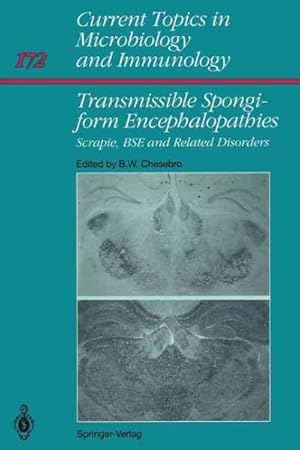 Seller image for Transmissible Spongiform Encephalopathies : Scrapie, Bse and Related Human Disorders for sale by GreatBookPrices