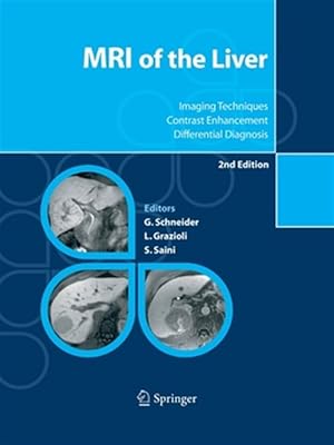 Imagen del vendedor de MRI of the Liver : Imaging Techniques, Contrast Enhancement, Differential Diagnosis a la venta por GreatBookPrices