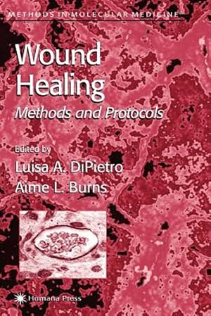 Immagine del venditore per Wound Healing : Methods and Protocols venduto da GreatBookPrices