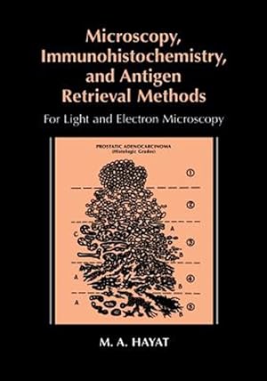 Bild des Verkufers fr Microscopy, Immunohistochemistry, and Antigen Retrieval Methods : For Light and Electron Microscopy zum Verkauf von GreatBookPrices