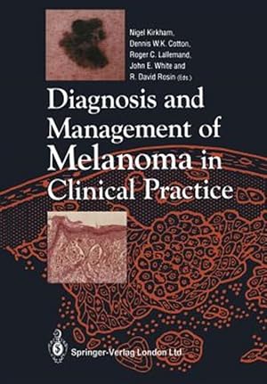 Imagen del vendedor de Diagnosis and Management of Melanoma in Clinical Practice a la venta por GreatBookPrices