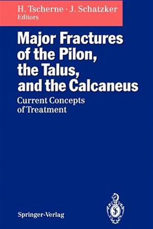 Imagen del vendedor de Major Fractures of the Pilon, the Talus, and the Calcaneus : Current Concepts of Treatment a la venta por GreatBookPrices