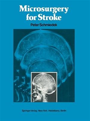 Image du vendeur pour Microsurgery for Stroke mis en vente par GreatBookPrices