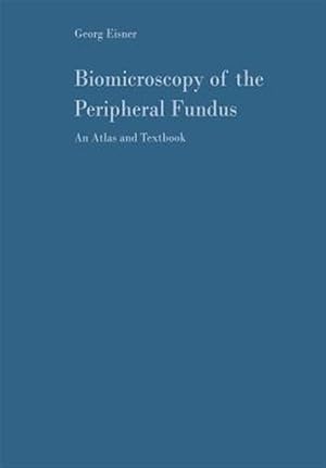 Seller image for Biomicroscopy of the Peripheral Fundus : An Atlas and Textbook for sale by GreatBookPrices