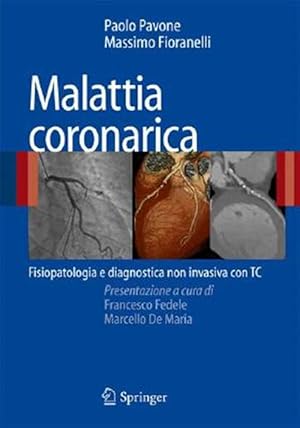 Seller image for Malattia Coronarica : Fisiopatologia E Diagnostica Non Invasiva Con Tc -Language: italian for sale by GreatBookPrices