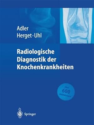 Seller image for Radiologische Diagnostik Der Knochenkrankheiten -Language: german for sale by GreatBookPrices