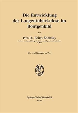 Seller image for Die Entwicklung Der Lungentuberkulose Im R�ntgenbild -Language: german for sale by GreatBookPrices