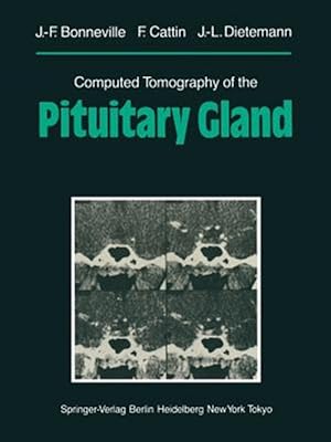 Imagen del vendedor de Computed Tomography of the Pituitary Gland : With a Chapter on Magnetic Resonance Imaging of the Sellar and Juxtasellar Region, by M. Mu Huo Teng and K. Sartor a la venta por GreatBookPrices