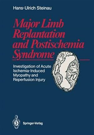 Immagine del venditore per Major Limb Replantation and Postischemia Syndrome : Investigation of Acute Ischemia-induced Myopathy and Reperfusion Injury venduto da GreatBookPrices