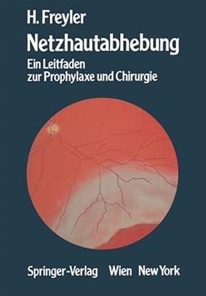 Immagine del venditore per Netzhautabhebung : Ein Leitfaden Zur Prophylaxe Und Chirurgie -Language: german venduto da GreatBookPrices
