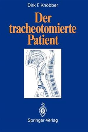 Seller image for Der Tracheotomierte Patient -Language: German for sale by GreatBookPrices