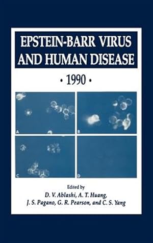 Seller image for Epstein-Barr Virus and Human Disease, 1990 for sale by GreatBookPrices