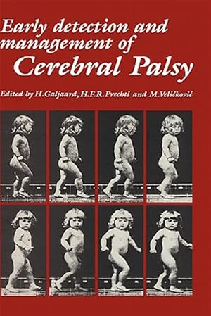 Imagen del vendedor de Early Detection and Management of Cerebral Palsy a la venta por GreatBookPrices