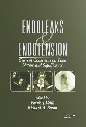 Seller image for Endoleaks and Endotension : Current Consensus on Their Nature and Significance for sale by AHA-BUCH GmbH