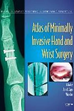 Seller image for Atlas of Minimally Invasive Hand and Wrist Surgery for sale by AHA-BUCH GmbH
