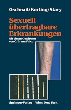 Seller image for Sexuell bertragbare Erkrankungen -Language: german for sale by GreatBookPricesUK