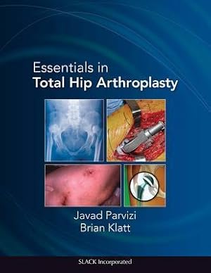 Seller image for Parvizi, J: Essentials in Total Hip Arthroplasty for sale by moluna