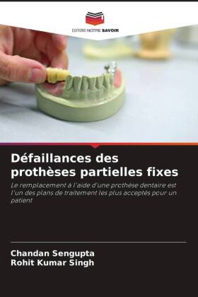 Bild des Verkufers fr Dfaillances des prothses partielles fixes zum Verkauf von moluna