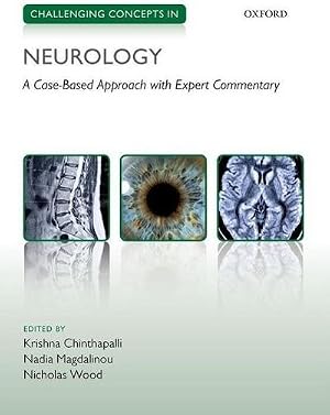 Seller image for Challenging Concepts in Neurology : Cases with Expert Commentary for sale by AHA-BUCH GmbH
