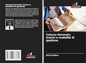 Imagen del vendedor de Calcare femorale: lesioni e modalit� di gestione a la venta por moluna