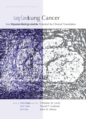 Seller image for Lung Cancer : Disease Biology and Its Potential for Clinical Translation for sale by GreatBookPricesUK