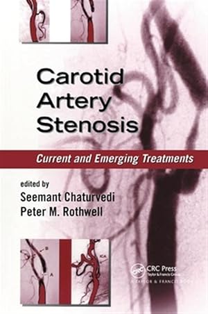 Immagine del venditore per Carotid Artery Stenosis : Current and Emerging Treatments venduto da GreatBookPricesUK