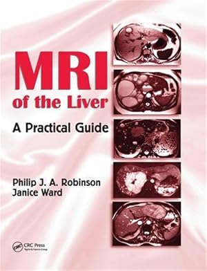 Imagen del vendedor de MRI of the Liver : A Practical Guide a la venta por GreatBookPricesUK