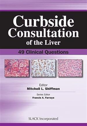 Seller image for Curbside Consultation of the Liver : 49 Clinical Questions for sale by GreatBookPricesUK