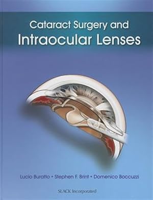 Seller image for Cataract Surgery and Intraocular Lenses : Intraocular Lenses for sale by GreatBookPricesUK