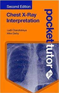 Imagen del vendedor de Pocket Tutor Chest X-Ray Interpretation a la venta por Vedams eBooks (P) Ltd