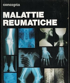 Seller image for Malattie Reumatiche for sale by Sergio Trippini