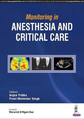 Bild des Verkufers fr Monitoring in Anesthesia and Critical Care zum Verkauf von moluna
