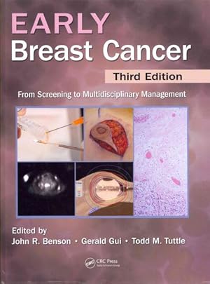 Immagine del venditore per Early Breast Cancer venduto da GreatBookPricesUK