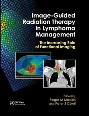 Immagine del venditore per Image-guided Radiation Therapy in Lymphoma Management : The Increasing Role of Functional Imaging venduto da GreatBookPrices