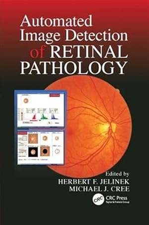 Immagine del venditore per Automated Image Detection of Retinal Pathology venduto da GreatBookPrices