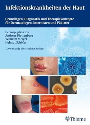 Bild des Verk�ufers f�r Infektionskrankheiten der Haut: Grundlagen, Diagnostik, Therapiekonzepte f. Dermatologen, Internisten u P�diater: Grundlagen, Diagnostik und Therapiekonzepte f�r Dermatologen, Internisten und P�diater : Grundlagen, Diagnostik und Therapiekonzepte f�r Dermatologen, Internisten und P�diater zum Verkauf von AHA-BUCH GmbH