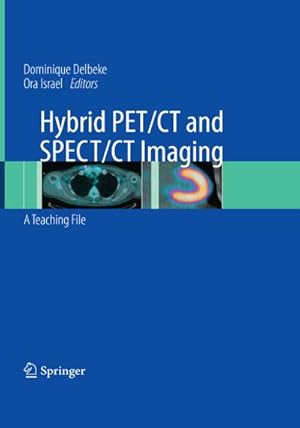 Bild des Verkufers fr Hybrid PET/CT and SPECT/CT Imaging zum Verkauf von buchversandmimpf2000
