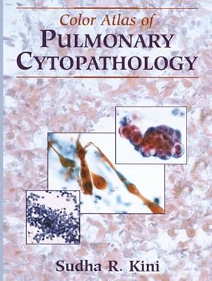 Bild des Verk�ufers f�r Color Atlas of Pulmonary Cytopathology zum Verkauf von buchversandmimpf2000