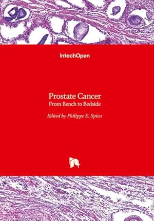 Bild des Verkufers fr Prostate Cancer zum Verkauf von buchversandmimpf2000